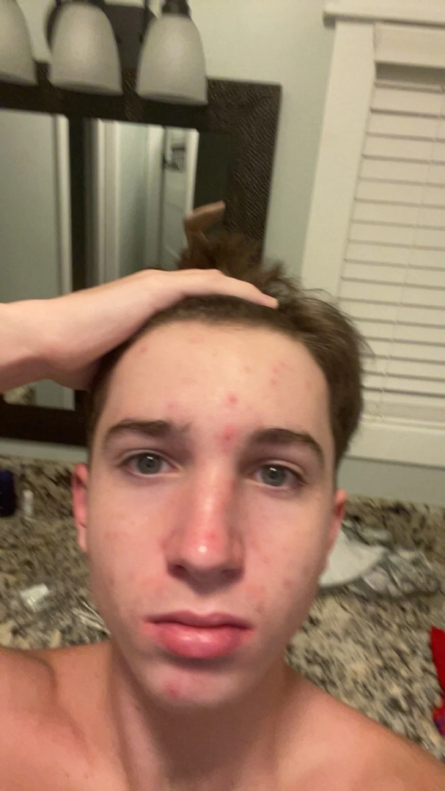A second customer photo before, showing spots on the forehead and nose